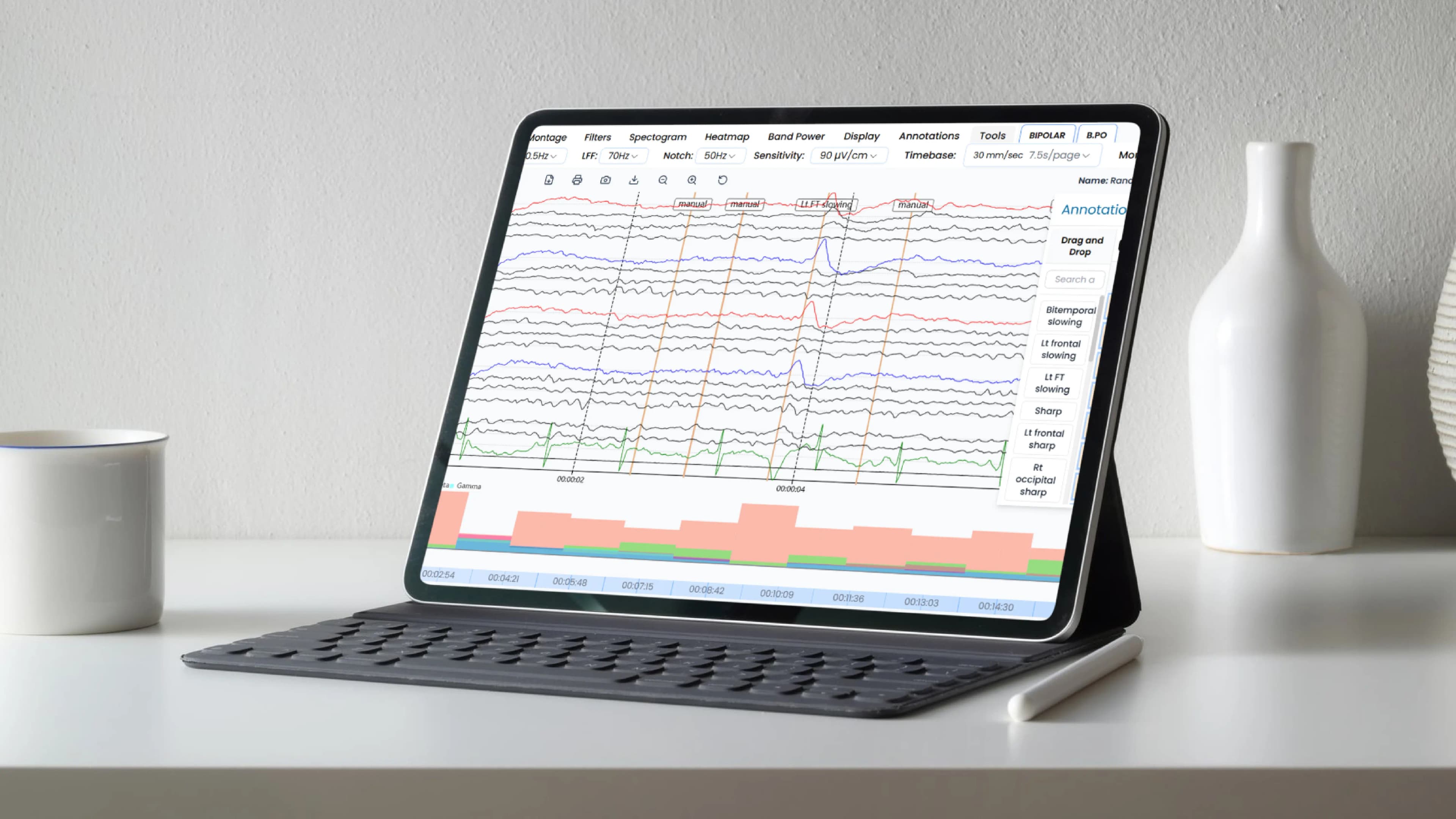 AI-Enabled, Real-Time Analysis