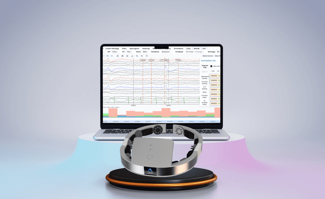 NeuroAstra neurological monitoring dashboard