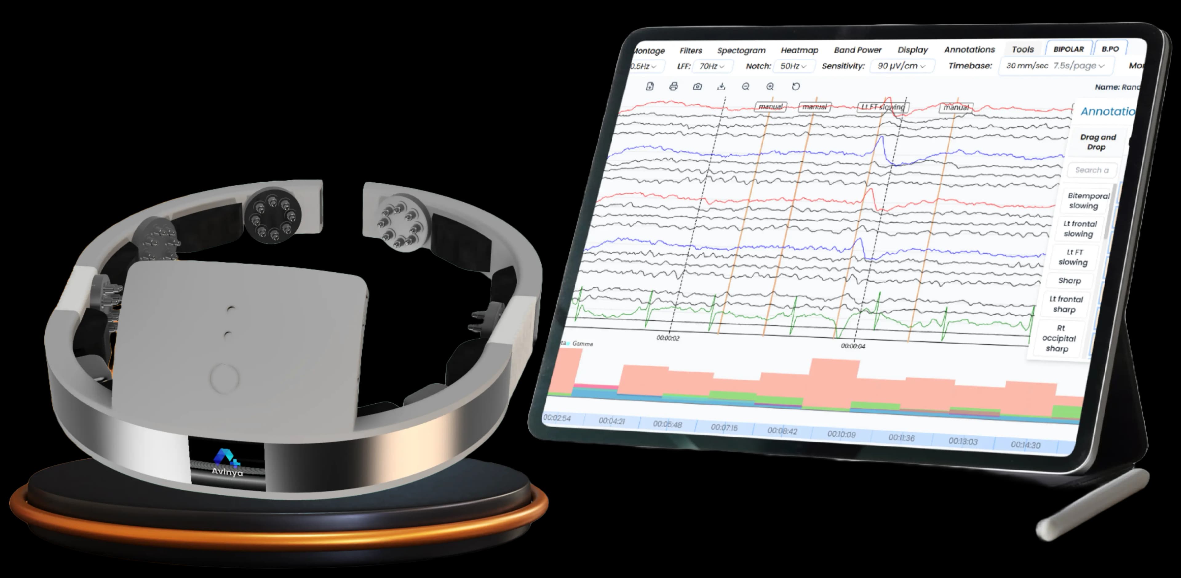 Avinya NeuroTech Monitoring System